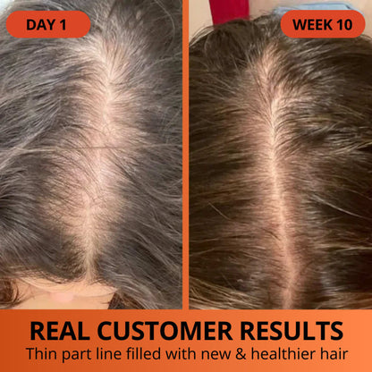 TrueHerb Pumpkin Seed Oil + Saw Palmetto Capsules